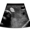 Thyroid Ultrasound Phantom (Thyroid Phantom with Vessels)-6