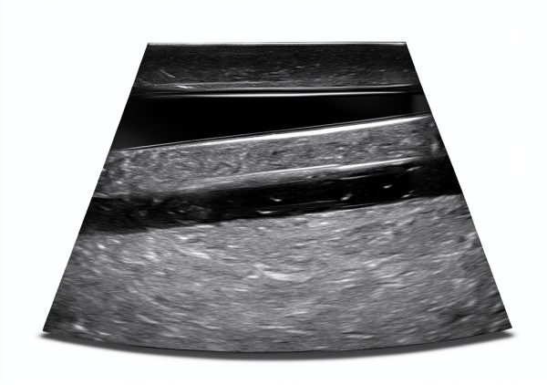 Thyroid Ultrasound Phantom (Thyroid Phantom with Vessels)-7