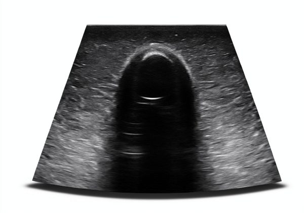 Thyroid Ultrasound Phantom (Thyroid Phantom with Vessels)-8